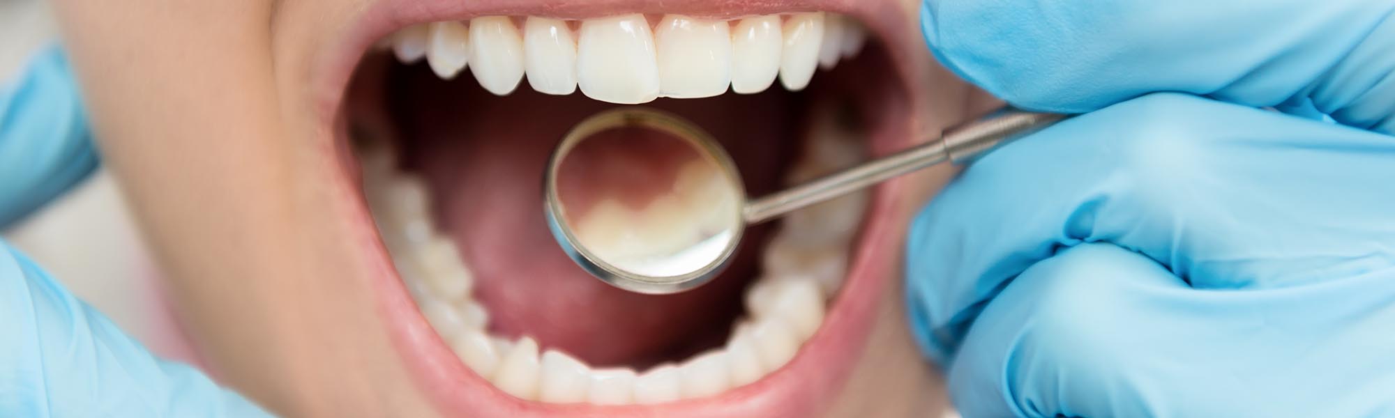 What Is Tooth Enamel and Why Is It Important?