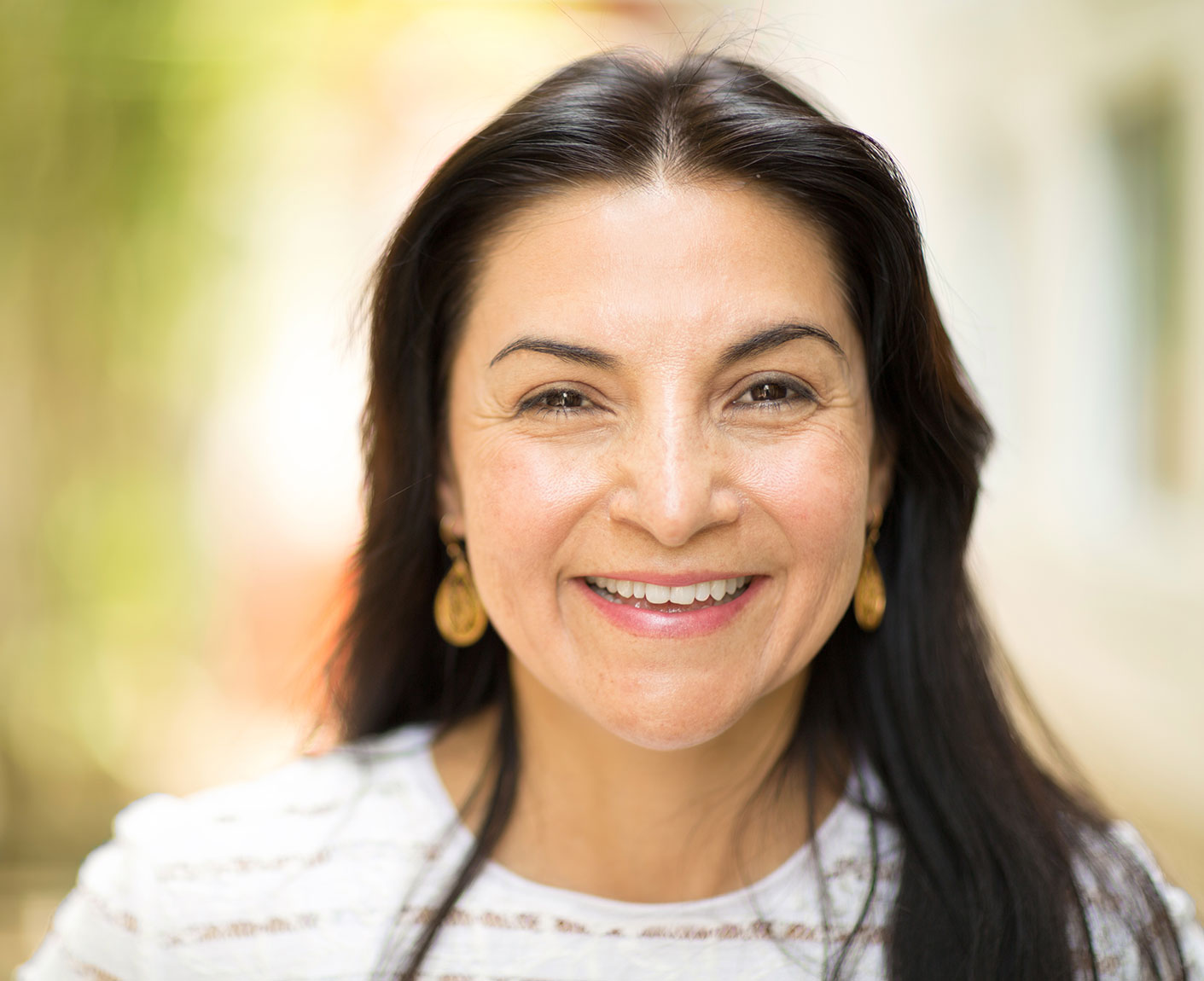 Dental Bonding Near Me West Covina CA