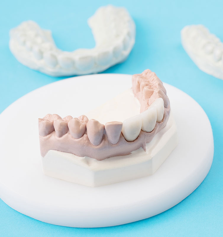 Dental Bridges in West Covina CA