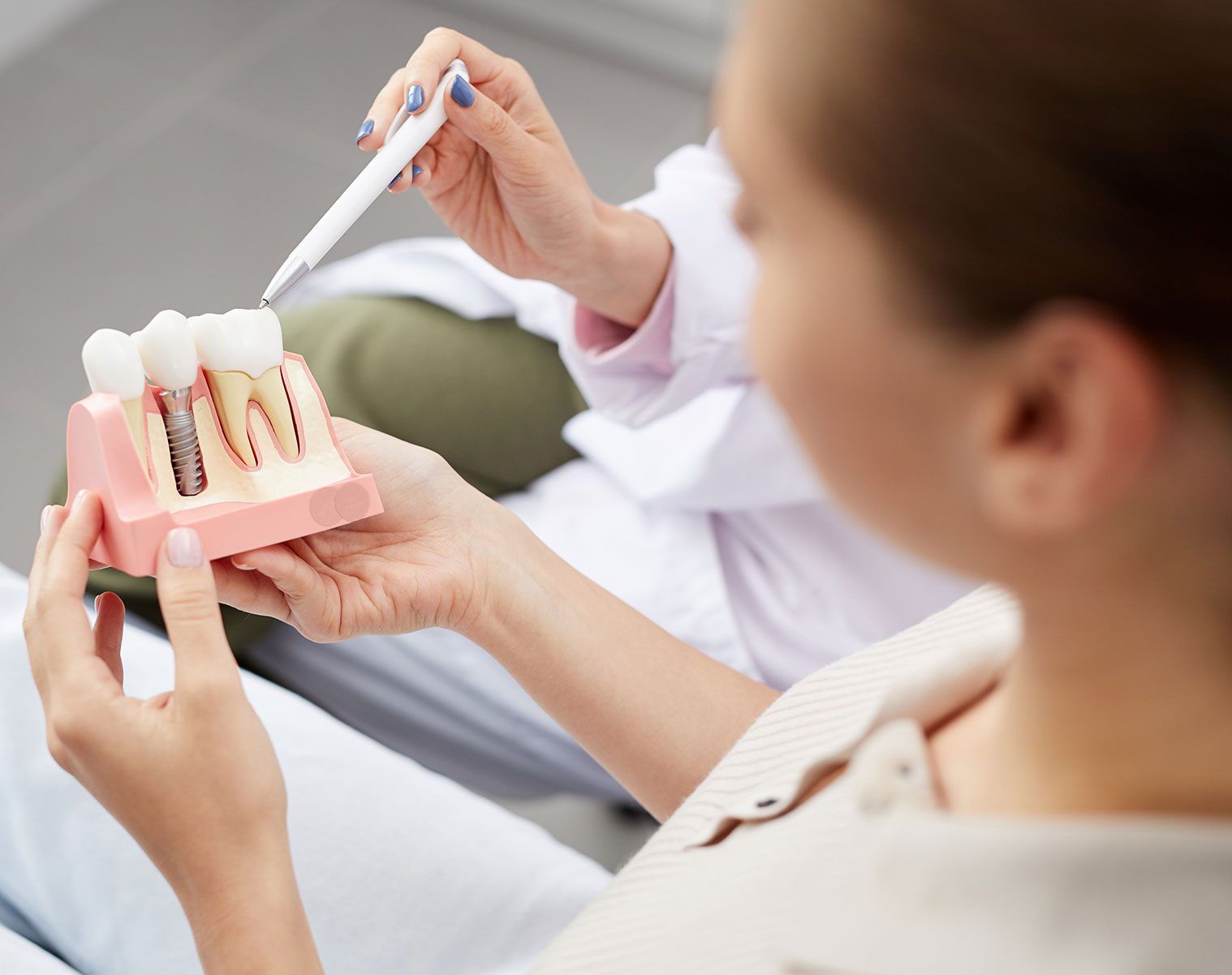 Dental Implants in West Covina CA