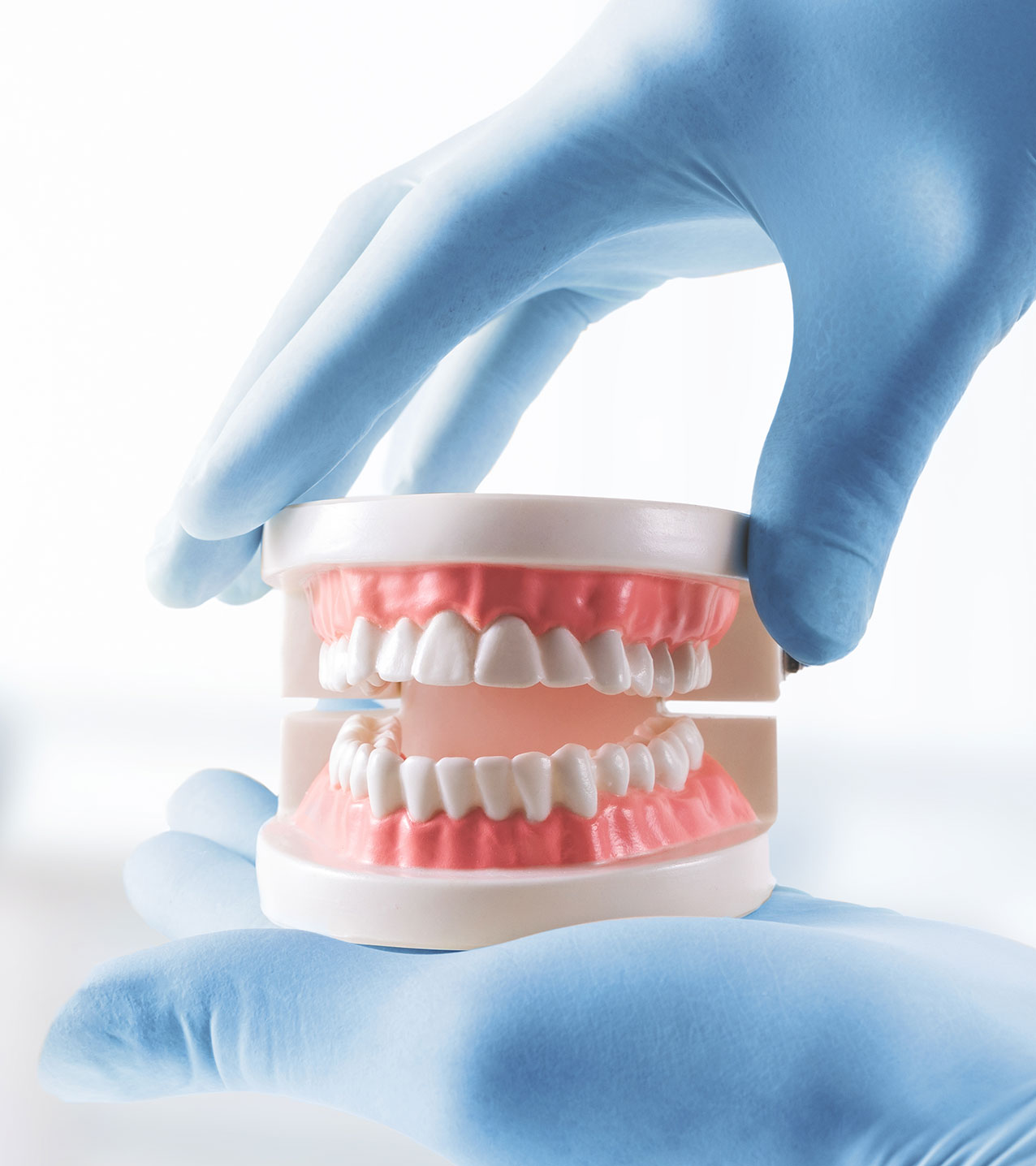 Overdentures West Covina CA